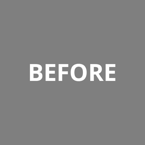 Procedure Before & After Image