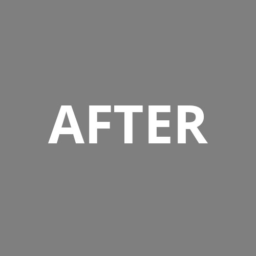 Procedure Before & After Image